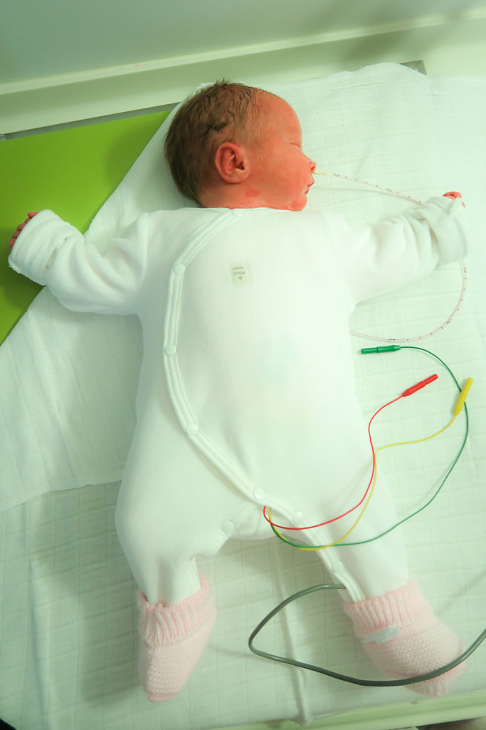 J17 – Dorénavant capable de réguler lui même sa température, le bébé est habillé pour être placé en berceau. Les électrodes et le scope continuent de surveiller les constantes vitales et la sonde gastrique de prendre le relais pour l’alimentation.